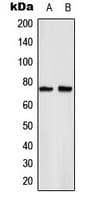 RELA / NFKB p65 Antibody (phospho-Ser529)