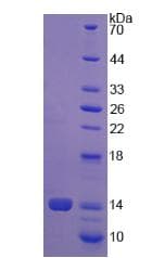 Human PLOD / PLOD1 Protein (Recombinant His)