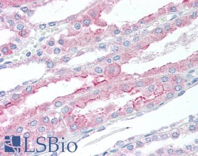 IHC-plus™ PTPRJ / CD148 Antibody