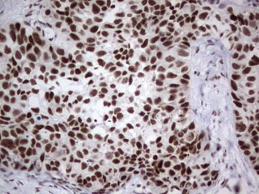 HDAC9 Antibody (aa181-460, clone OTI7G2, Carrier-free)