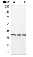 Polyclonal Rabbit anti-Human KLK11 / Kallikrein 11 Antibody (Internal, WB)