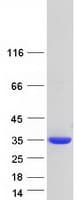 Human NIT1 Protein (Recombinant Myc-DDK (Flag))