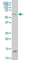 ARA70 / NCOA4 Antibody (clone 1E5)