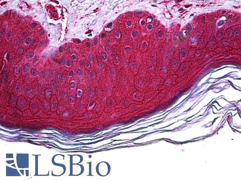 IHC-plus™ FBXO11 Antibody (clone 4C12)