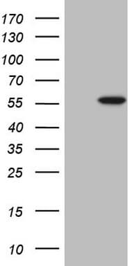 Monoclonal Mouse anti-Human ABAT Antibody (clone OTI6H1, aa29-323, IHC, WB)