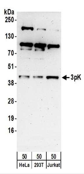 MAPKAPK3 Antibody (aa1-50)