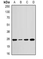 ANAPC10 / APC10 Antibody
