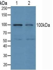 E6AP / UBE3A Antibody (aa158-407, APC)