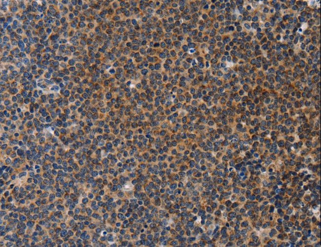 Polyclonal Rabbit anti-Human STRADB / ALS2CR2 Antibody (IHC, WB)