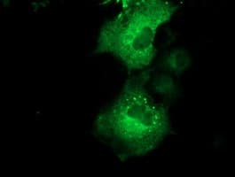 QPRT Antibody (clone OTI4E5)