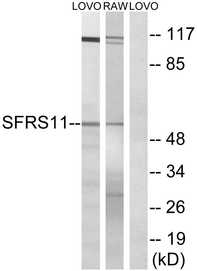 SRSF11 / SFRS11 Antibody (aa211-260)