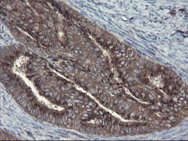 GCP60 / ACBD3 Antibody (clone OTI1B5)