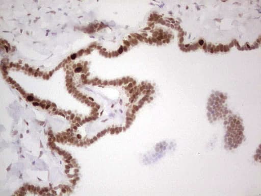 Monoclonal Mouse anti-Human RB1 / Retinoblastoma / RB Antibody (clone OTI3F11, aa309-590, IHC, WB)