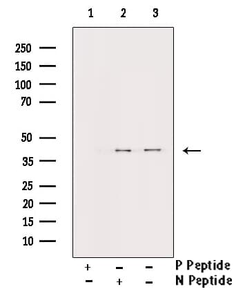 AURKB / Aurora-B Antibody (phospho-Thr232)