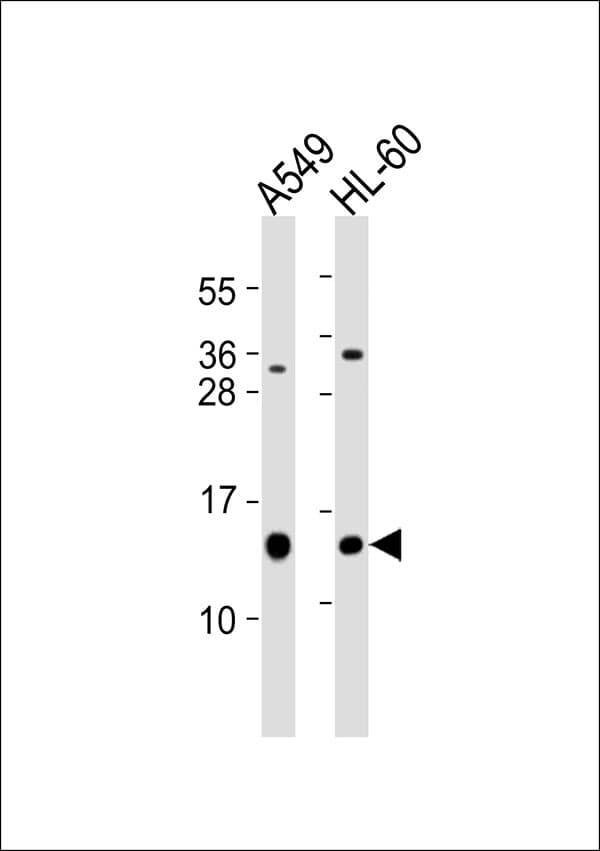 LGALS1 / Galectin 1 Antibody