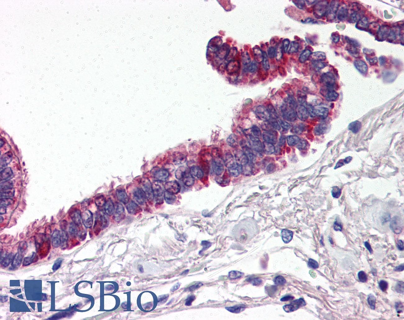IHC-plus™ Polyclonal Rabbit anti-Human RPAIN Antibody (IHC, WB)