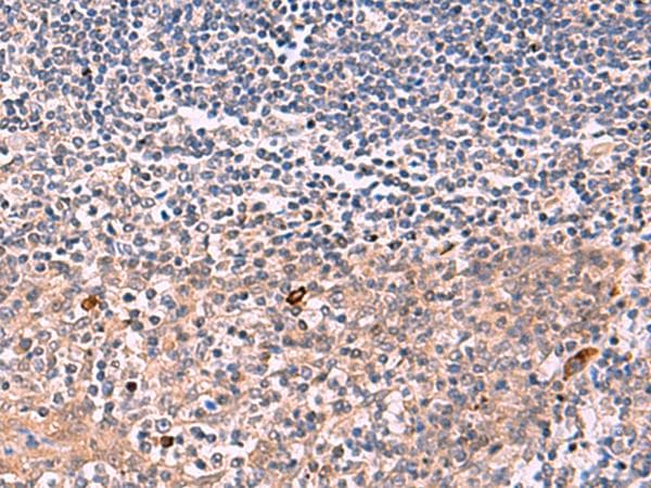 IFNA1 / Interferon Alpha 1 Antibody