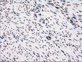 PLK1 / PLK-1 Antibody (clone OTI1D4)