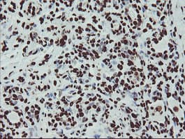 Monoclonal Mouse anti-Human NONO / P54NRB Antibody (clone OTI2E7, IHC, WB)