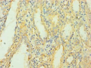 Polyclonal Rabbit anti-Human MCPH1 Antibody (aa536-835, IHC, WB)