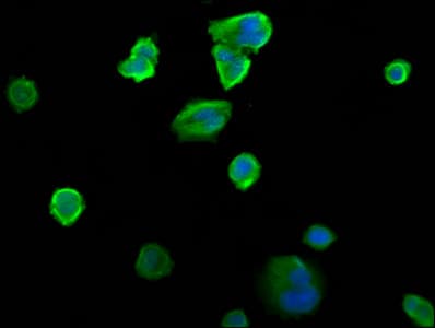 Polyclonal Rabbit anti-Human SIAH2 Antibody (IHC, IF)