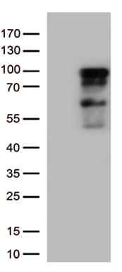Monoclonal Mouse anti-Human ZNF226 Antibody (clone OTI8G4, WB)