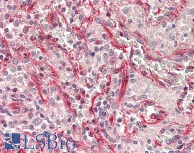 IHC-plus™ NUCB1 / Nucleobindin Antibody (clone 1H8-2C11)