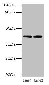 Polyclonal Rabbit anti-Human LIPA / Lysosomal Acid Lipase Antibody (aa28-372, IHC, WB)