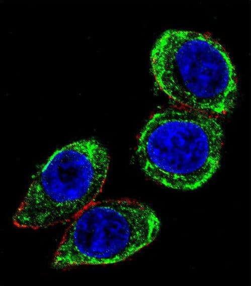 IHC-plus™ KRT18 / CK18 / Cytokeratin 18 Antibody (aa401-430)
