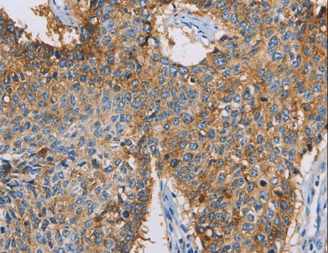 CDCP1 Antibody