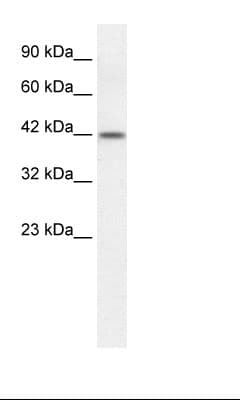 ESR2 / ER Beta Antibody (aa82-131)
