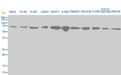 HSPA2 Antibody (clone S51)
