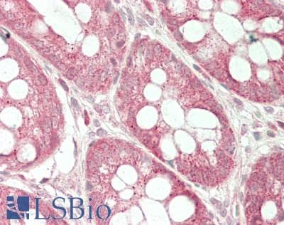 Polyclonal Rabbit anti-Human GATC Antibody (IHC, WB)