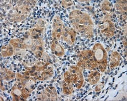 LIPG / Endothelial Lipase Antibody (clone OTI1D9, Carrier-free)