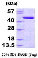 Human ADK / Adenosine Kinase Protein (Recombinant His)