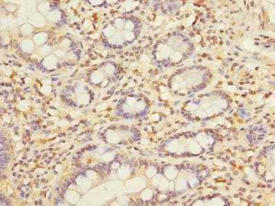 SLC22A18AS Antibody