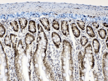 MSI1 / Musashi 1 Antibody