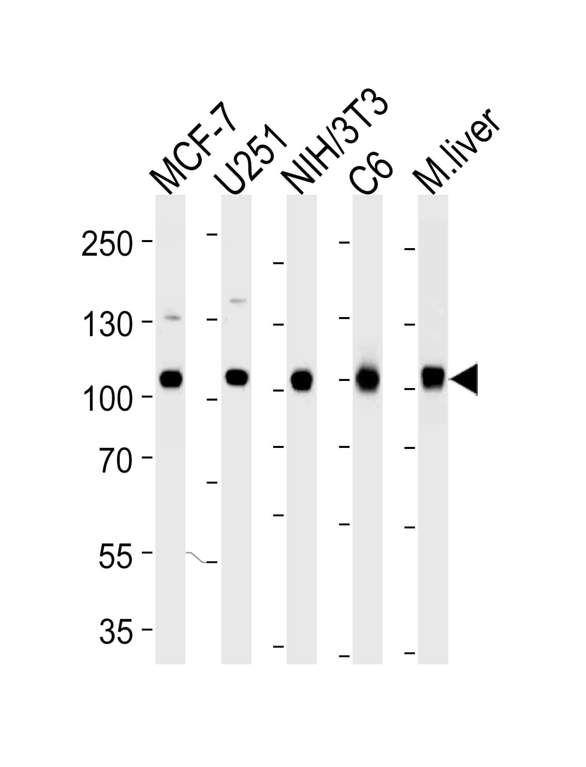 Monoclonal Mouse anti-Human VCP Antibody (clone 1344CT150.163.114, IF, WB)