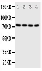 PAK6 Antibody (aa16-32)