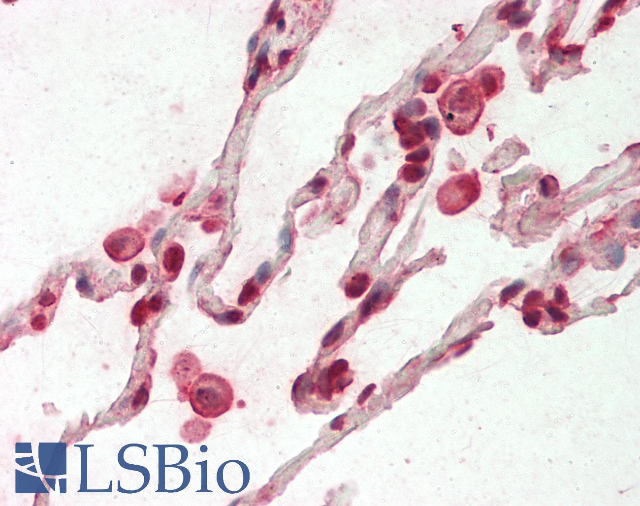 IHC-plus™ FANCC Antibody (clone 6E7)