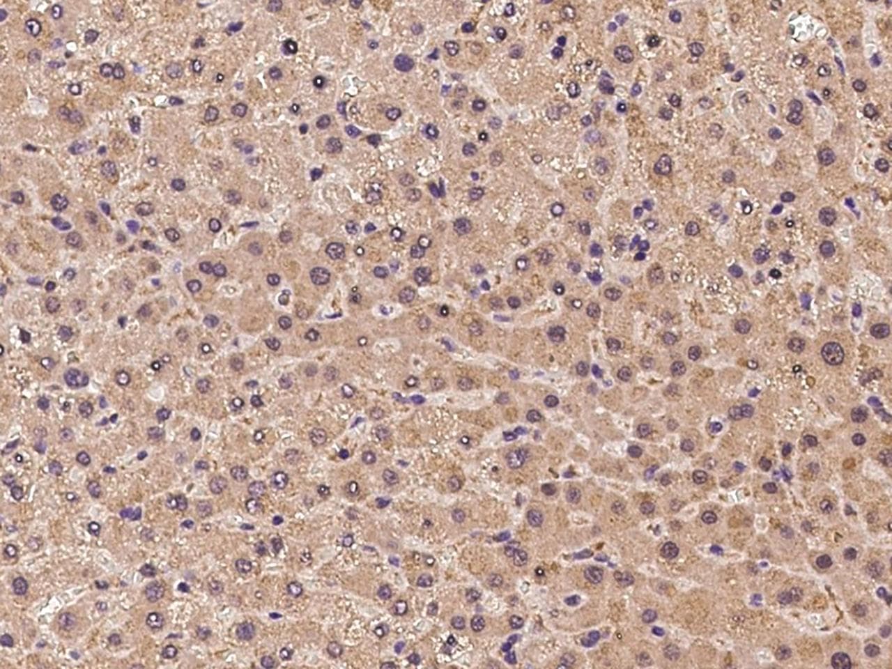 Polyclonal Rabbit anti-Human USP32 Antibody (IHC)