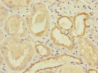 Polyclonal Rabbit anti-Human MYBL1 / A-MYB Antibody (IHC)