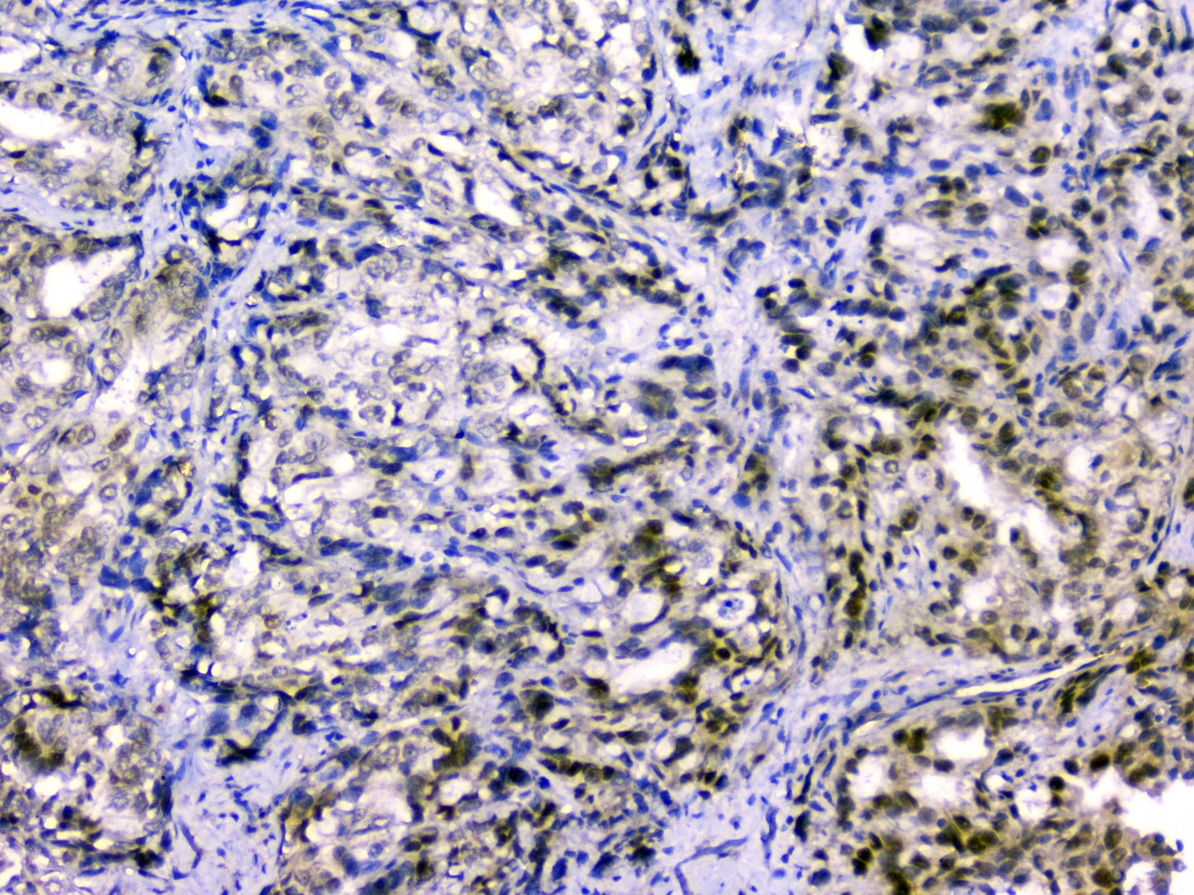 CUL2 / Cullin 2 Antibody