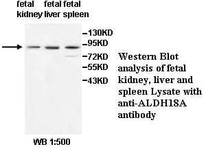 ALDH18A1 Antibody (aa10-257)