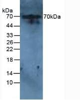 IL6R / IL6 Receptor Antibody (aa214-348)