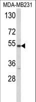 CYP2A13 Antibody (aa446-477)