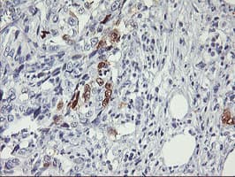 SERPINB2 / PAI-2 Antibody (clone OTI4E6, Carrier-free)