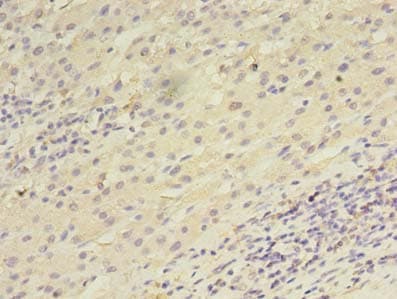 UTP23 Antibody