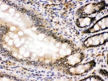 NONO / P54NRB Antibody