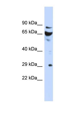 Polyclonal Rabbit anti-Human DCUN1D3 Antibody (aa35-84, WB)